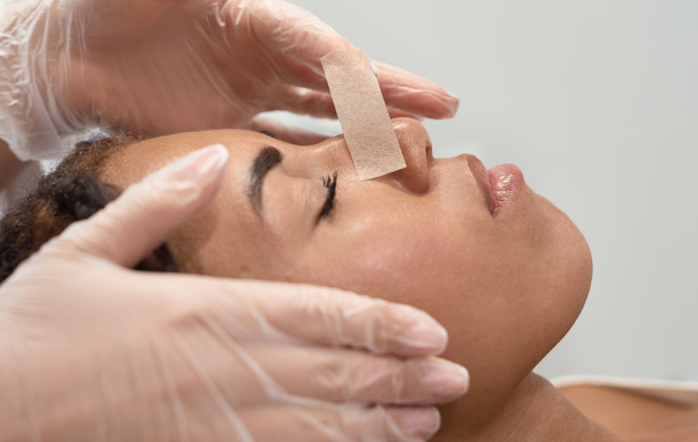 Rhinoplasty Taping After Cast Removal: Does It Reduce Swelling?