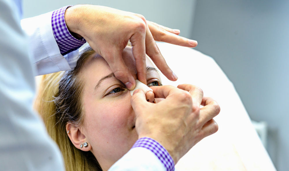 Rhinoplasty Swelling Stages