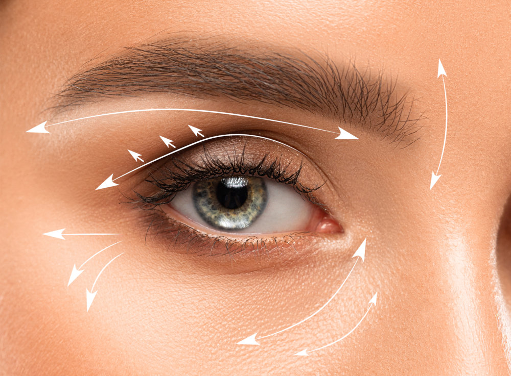 Blepharoplasty Procedure – Upper and Lower Eyelid Surgery in Toronto Before-and-after concept of upper and lower eyelid rejuvenation procedure