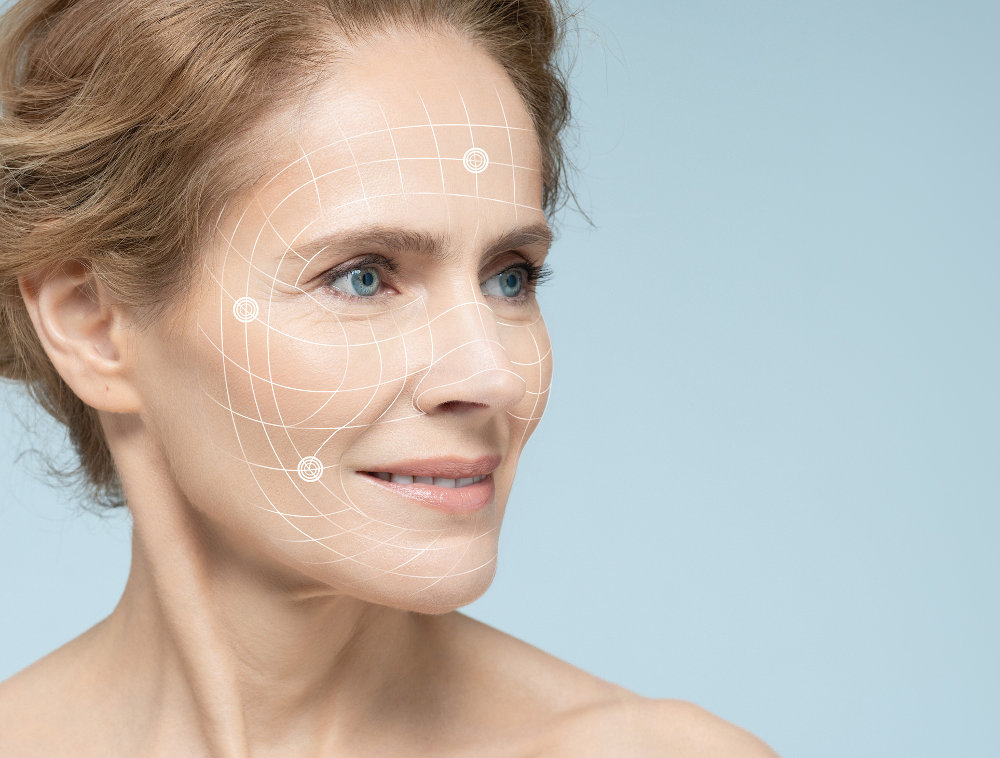Facelift Techniques and Costs in Toronto – 2026 Overview Mature woman showing facial lifting areas typically treated during a facelift