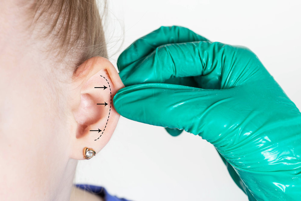 Otoplasty and Earlobe Repair Cost in Toronto – 2026 Guide Plastic surgeon assessing a patient’s ear for otoplasty or earlobe repair