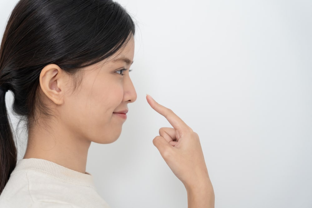  Rhinoplasty procedure to enlarge nose size, improve nasal bridge and tip projection for facial balance.