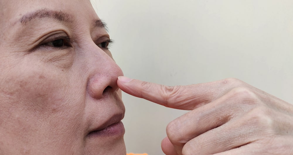 Rhinoplasty procedure to lengthen the nose tip for better facial balance and improved side profile.