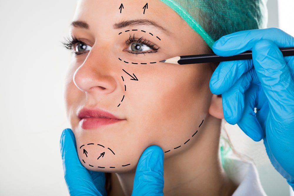 Surgeon drawing facelift lines on a woman’s face during consultation for the Optimum Mobility Facelift.