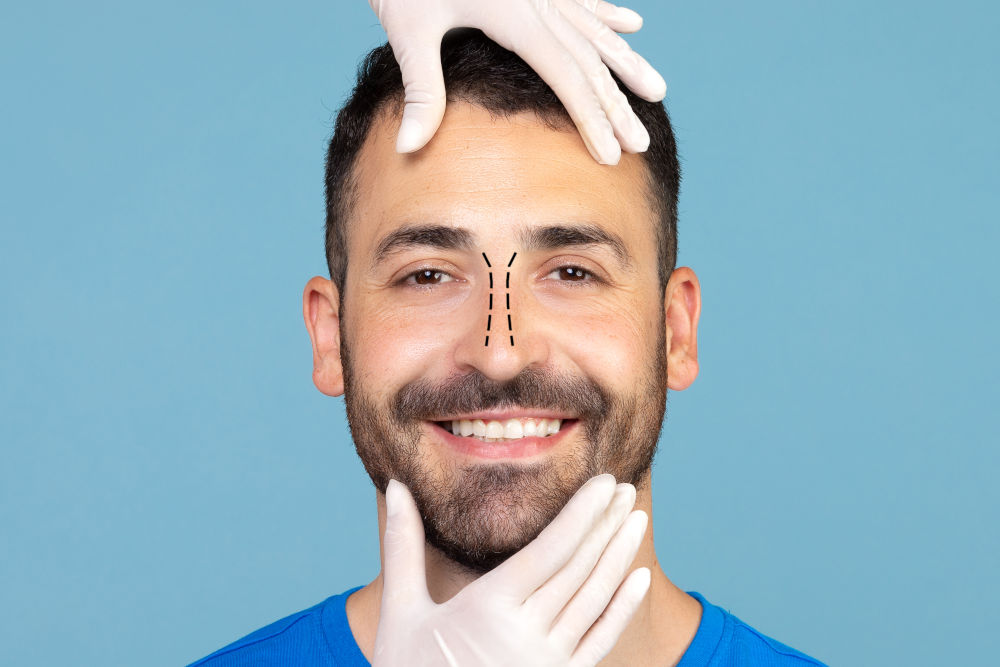 How Rhinoplasty Fixes a Crooked Nose